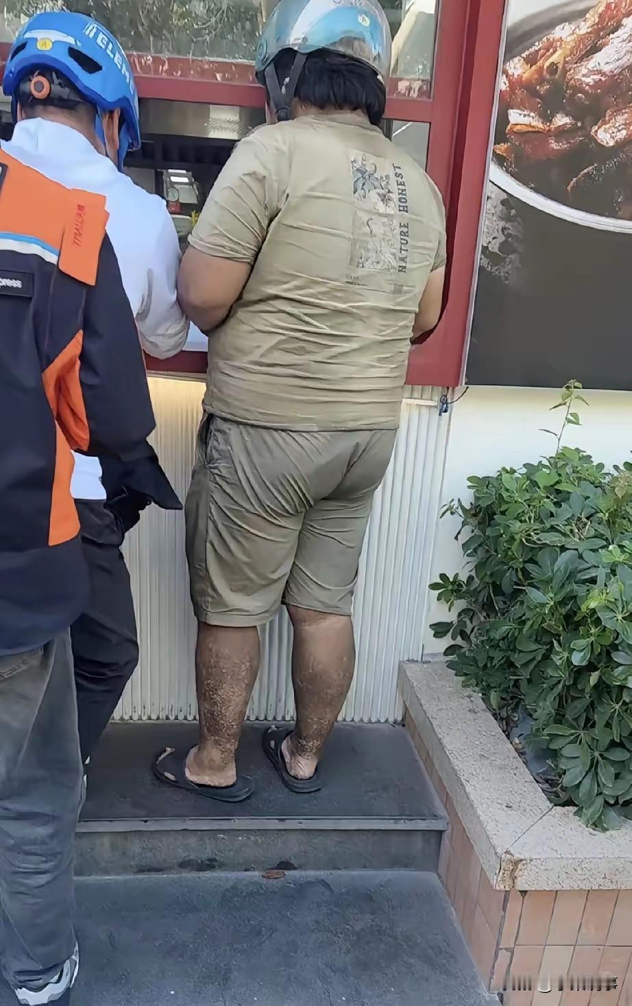 他送过来的外卖你们敢吃不？刷到个外卖员的背影，直接给我看傻了——这腿上密密麻麻