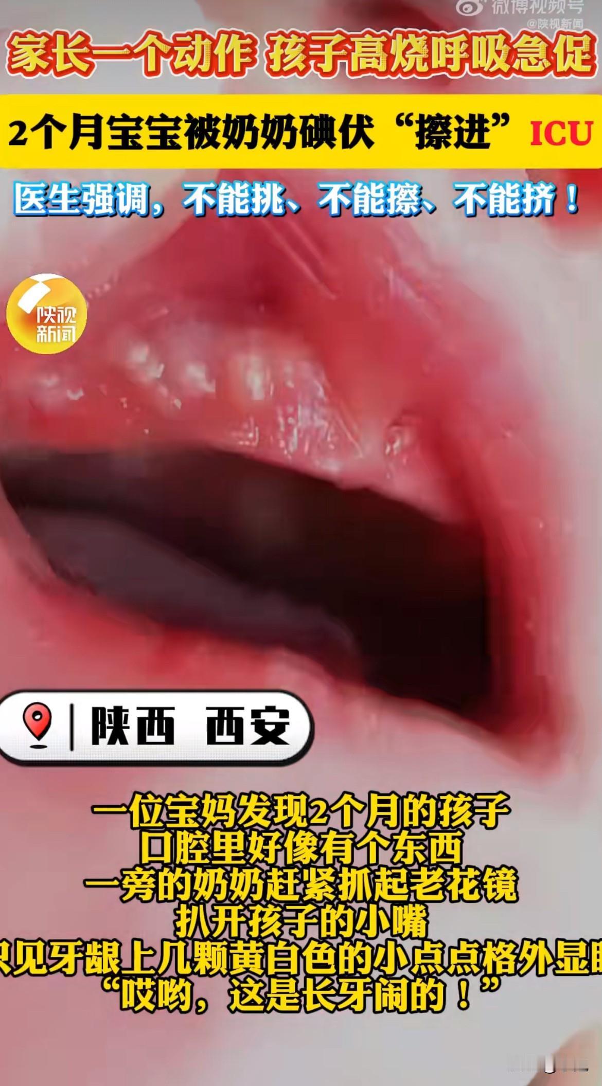 宝妈先发现宝宝嘴里有点异样，牙龈上有几颗黄白色的小点点。奶奶戴上老花镜一看，特别