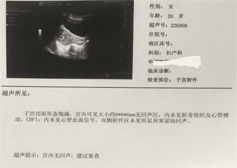 胎儿胎心停止千万不要立即终止妊娠, 坚持一下也许会有奇迹发生