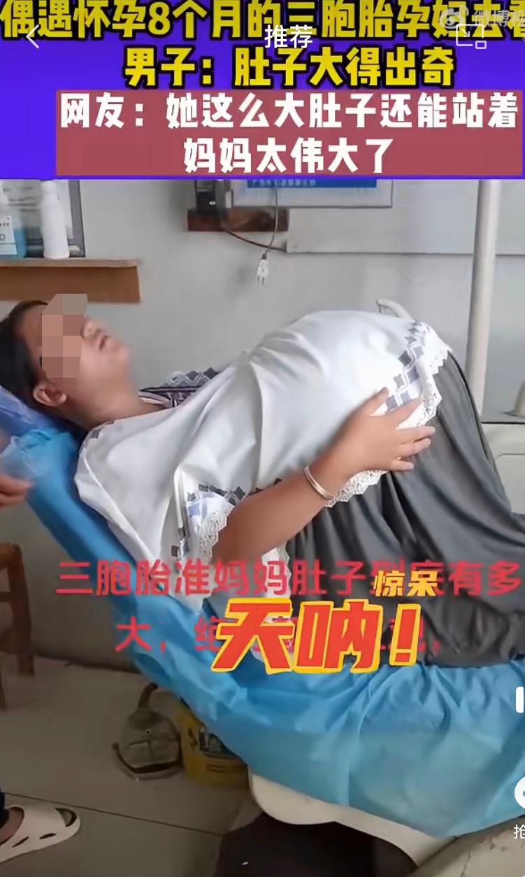 要死了，怀三胞胎！怀三胞胎，肚子大的离奇，不可思议。一位孕妈去看牙医，不