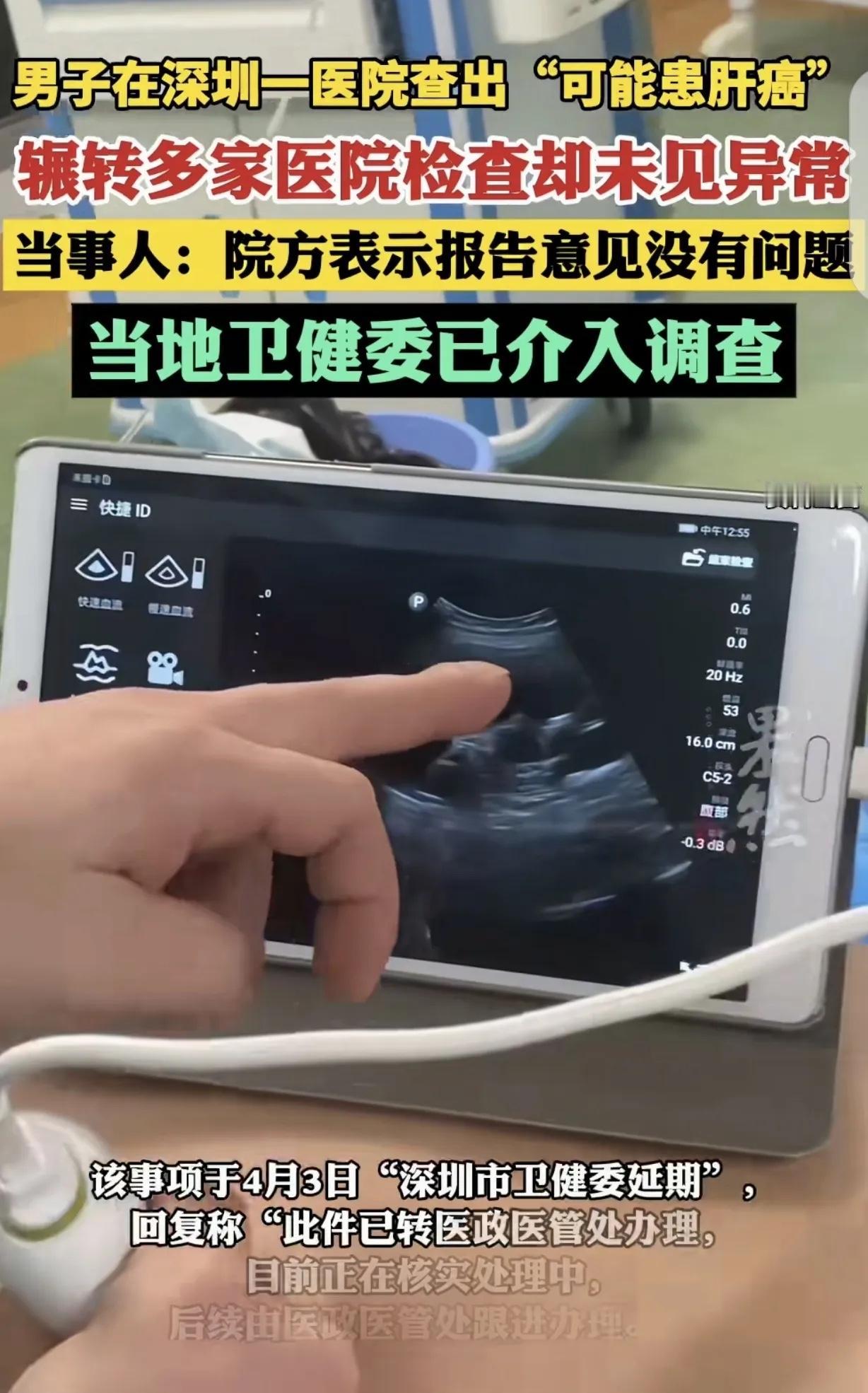 “真荒唐！”广东深圳，一男子在医院查出“可能患肝癌”，可把他吓坏了，觉得天都塌了