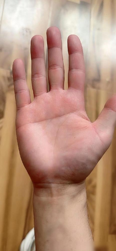 断掌的人命运都很悲惨吗？我是不相信迷信的，但是有些事让我现在也不得不信，村里一个