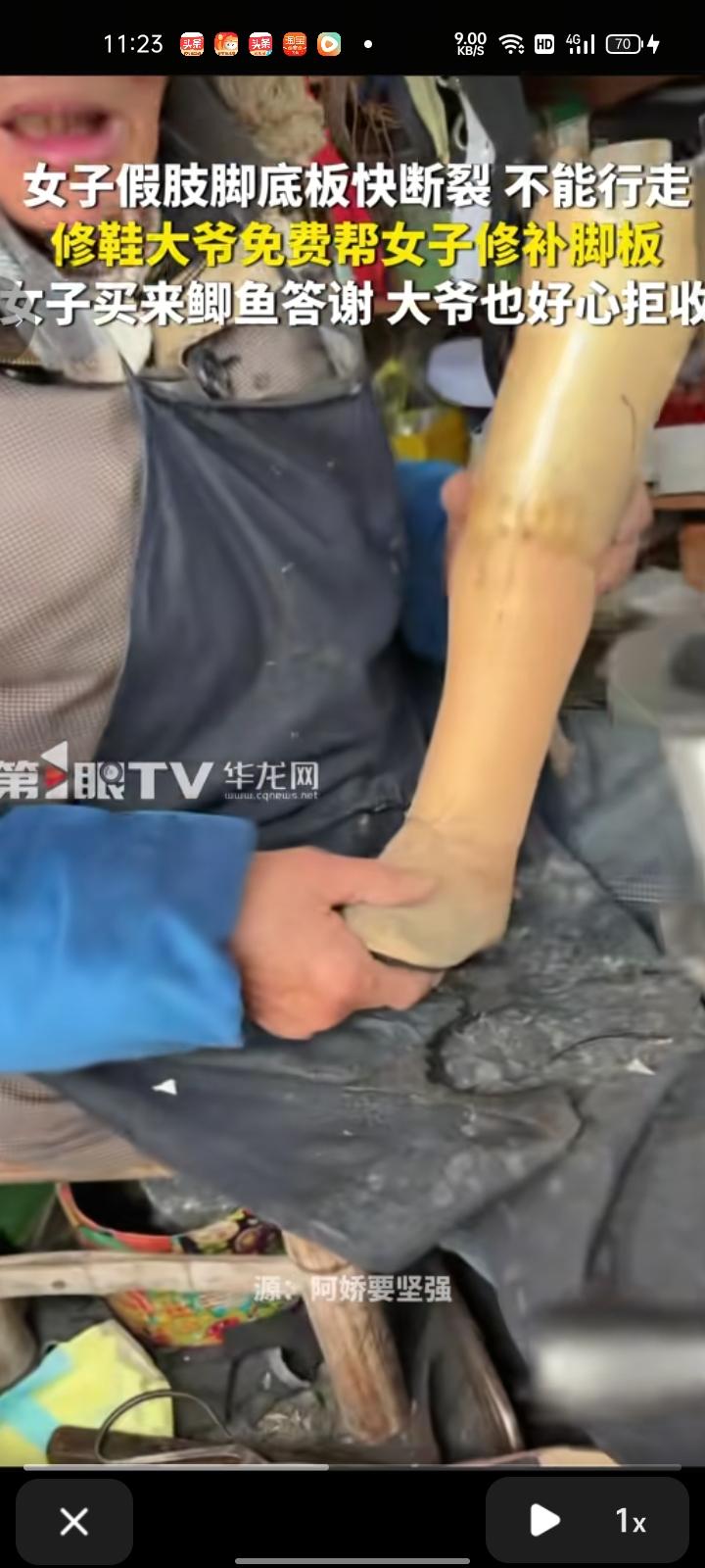 1月30日，江苏无锡。刘女士戴着假肢走路时，假肢脚底板块断裂，换一个要一万块钱。