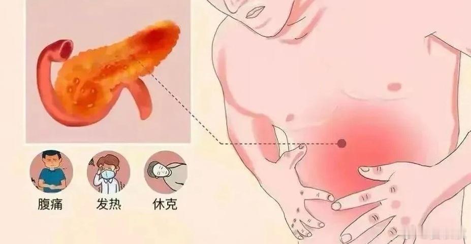 一碗鸡爪朋友Q君，昨天被一碗鸡爪“打倒”了。下午闲着没事，Q君一边看《甄嬛传》，