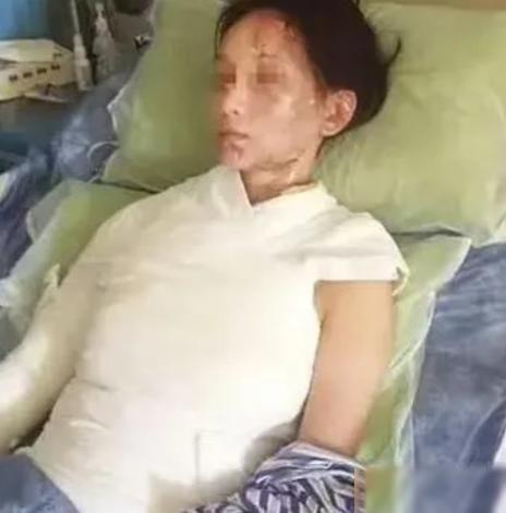“这就是嘴欠的下场”！一盆滚烫高汤从头顶浇下，28岁温州姑娘林某的人生自此彻底坍