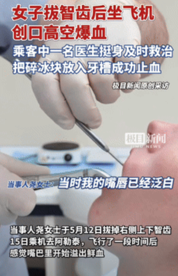 “怪不得飞行员不能有伤疤！”女子拔智齿仅3天后坐飞机，伤口竟在高空爆开，因失血过