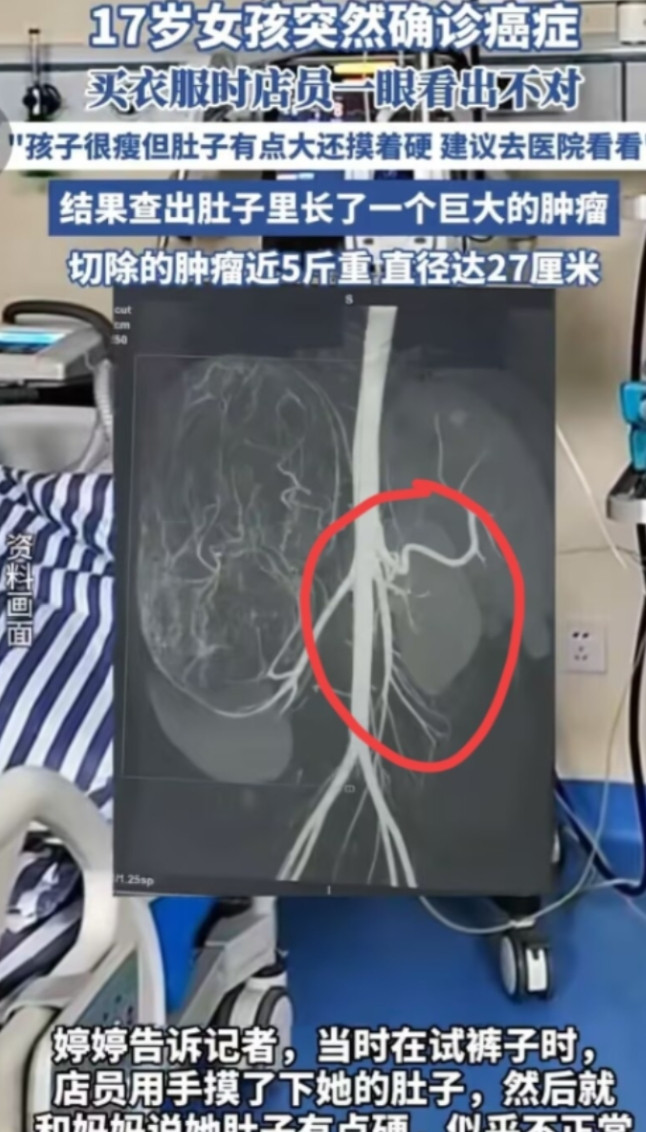 “幸亏发现了！”广东17岁女孩和妈妈一起逛街买衣服，在试裤子的时候，老板娘发觉女