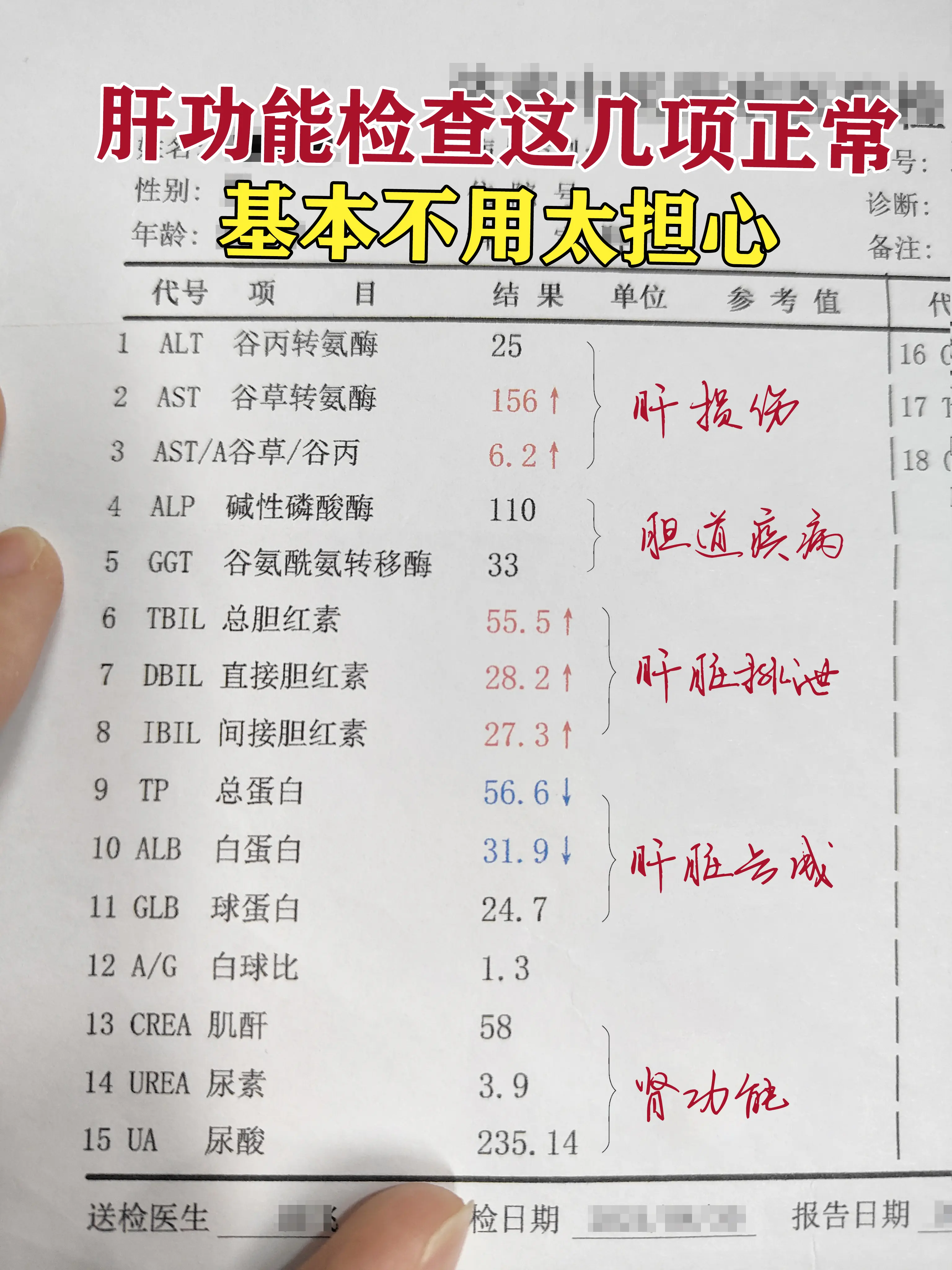 这位患者。乙肝多年，谷丙虽然正常，但谷草转氨酶明显升高，肝细胞深层受损...