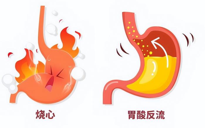 反流性食管炎，不过就是肝郁气滞、脾胃失和了大家好，我是中医陈玉龙。如今行医3