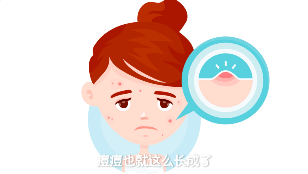 青春痘治疗排名_青春痘激光治疗(2)