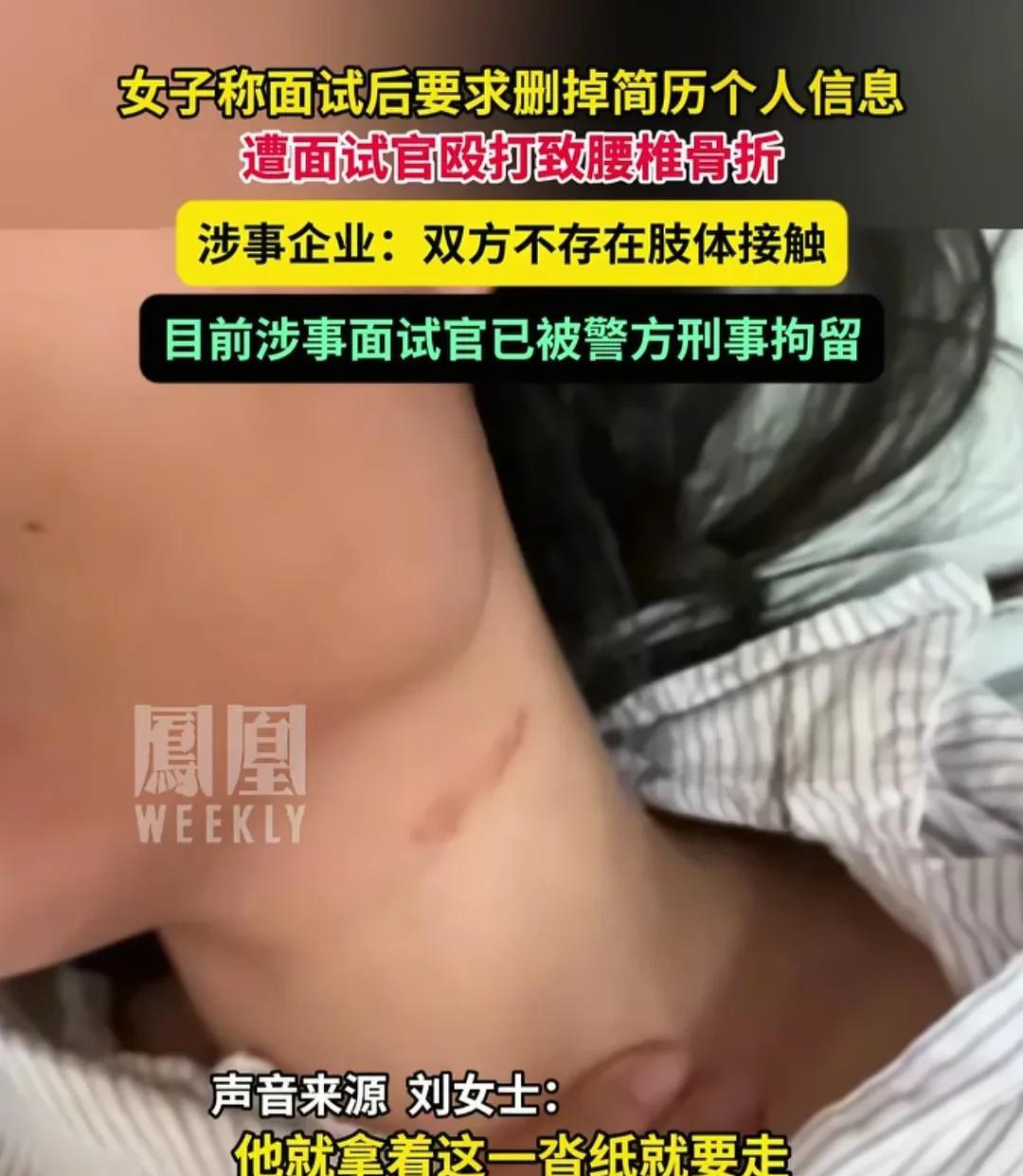 大快人心！深圳面试打人事件，女子坚决不和解，她伤情鉴定为轻伤二级，男老板已被刑拘
