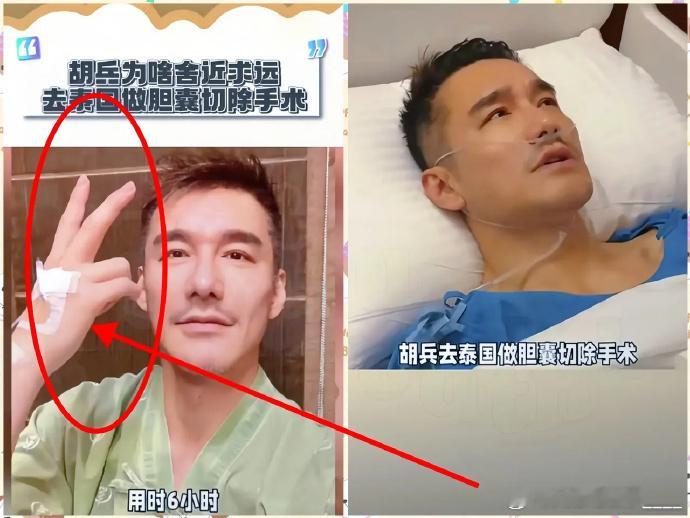有钱人的脑回路真让人看不懂！就说胡兵做个胆结石手术，放着国内一小时就能搞定的