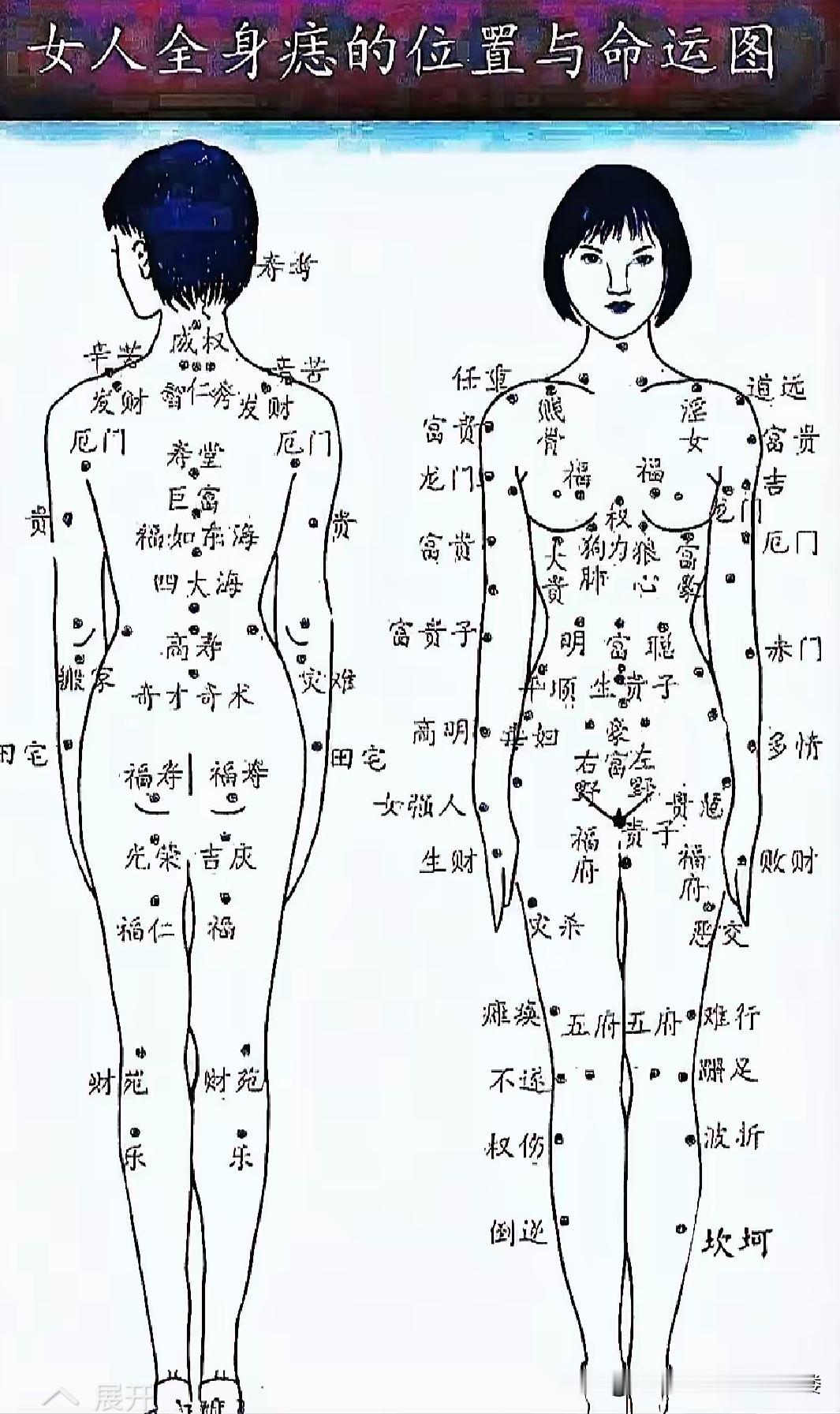 古人觉得人身上的痣和富贵贫贱有关，像《麻衣相法》《柳庄相法》里就有“一痣贫、二痣