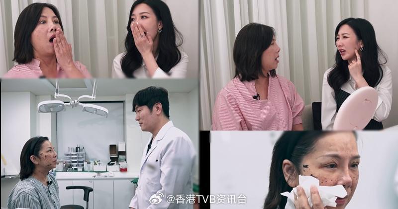 明报：艺人黄梓玮细说整容失败阴影陈嘉佳心动想试“直角肩”“埋线”由何依婷（Re