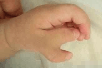 怀孕三个月做了美甲, 准妈妈去医院做四维彩超, 看到宝宝不肯接受