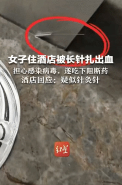 倒了大霉！”重庆女子入住昆明一家酒店，不料手指被窗台上的一根针给扎伤，女子担心感
