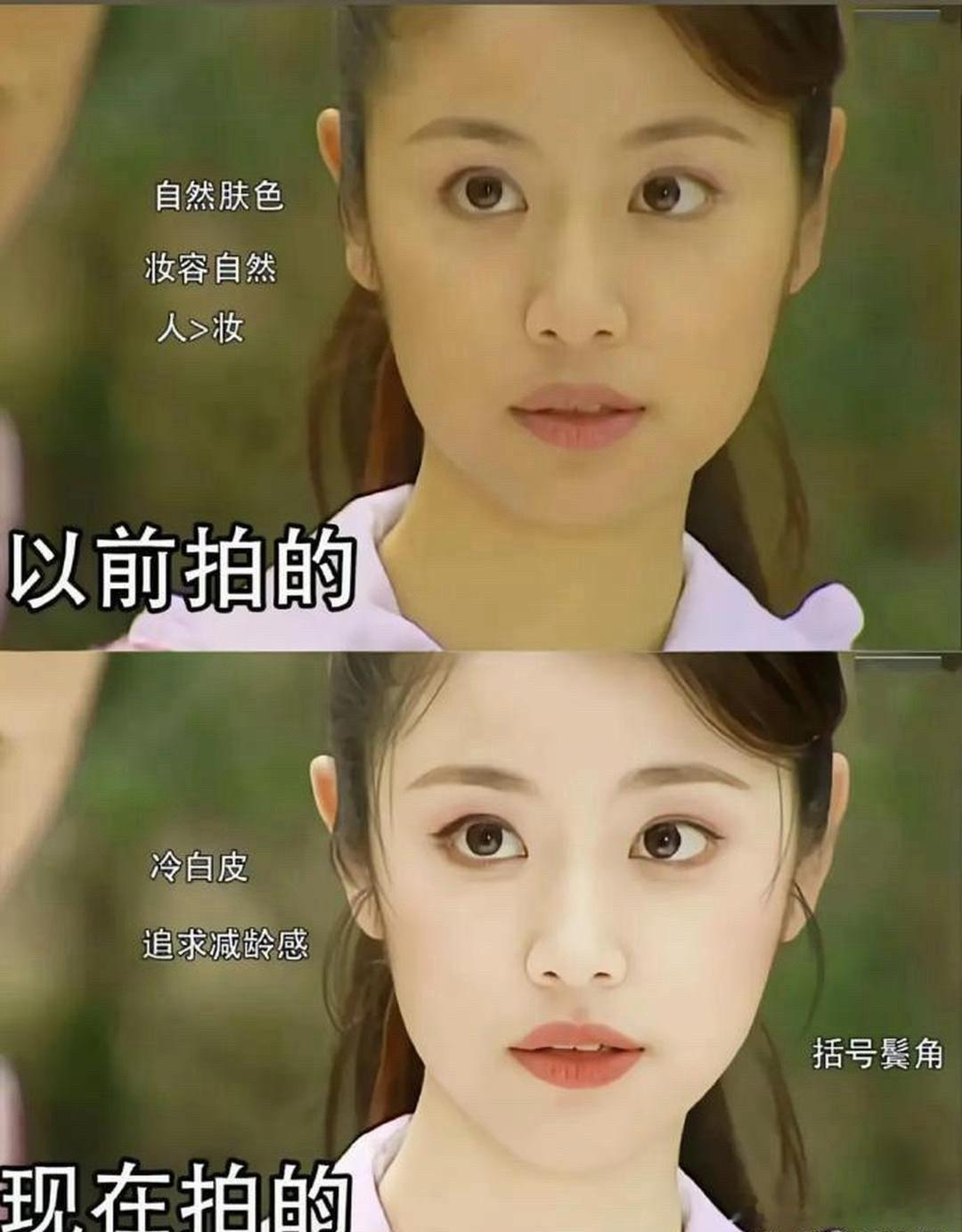 现在都不允许女明星脸上有瑕疵，有黑眼圈了