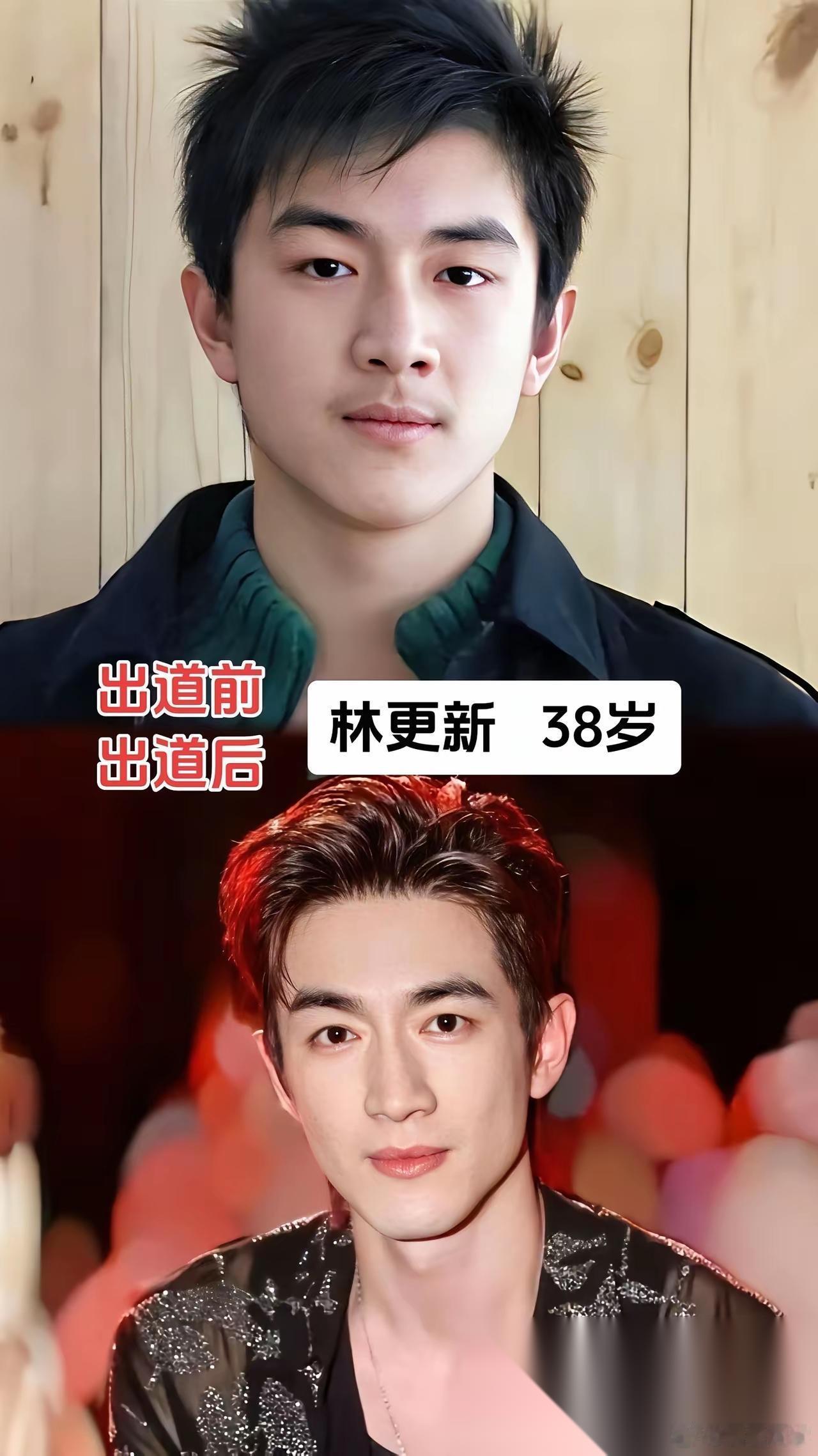 周深出道前，出道后的对比图林更新出道前出道后对比图成毅出道前，出道后对比图郭麒麟出道前，出道后对比图