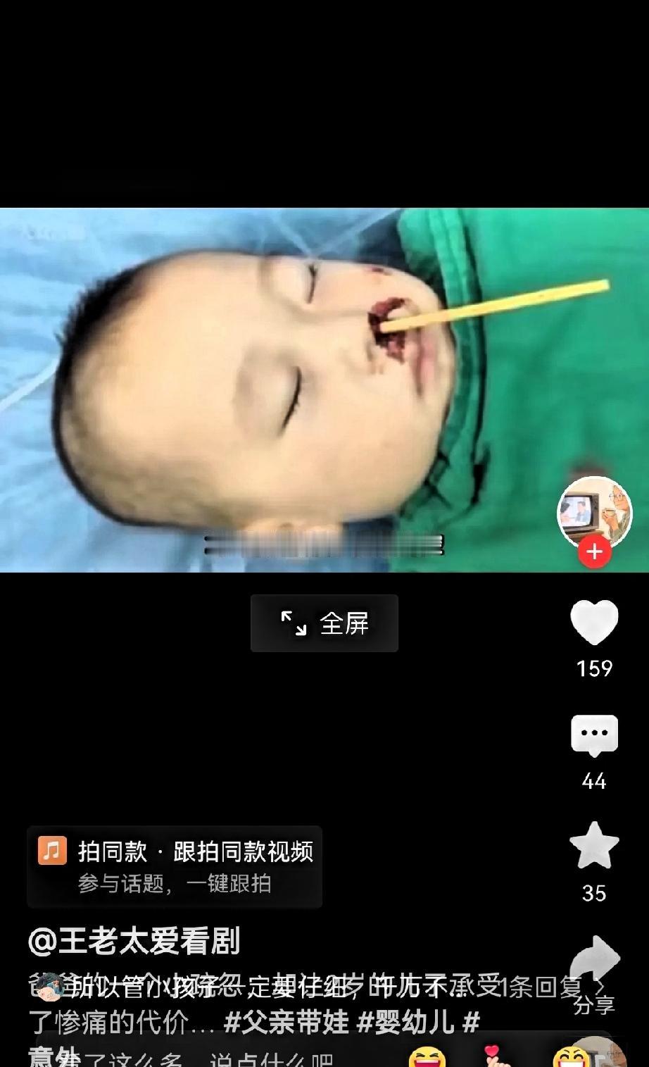 太痛心！6月21日重庆发生一幕惨剧！2岁宝宝独自拿筷子吃面，爸爸接电话疏忽一分