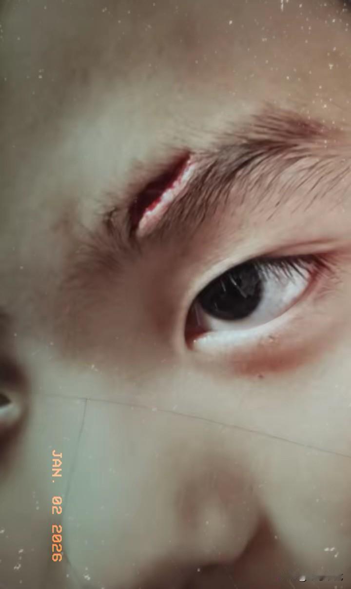 心疼又气愤！这下真的惹大祸了！孙子上学起晚在屋里磨磨蹭蹭，奶奶一时气急狠狠一