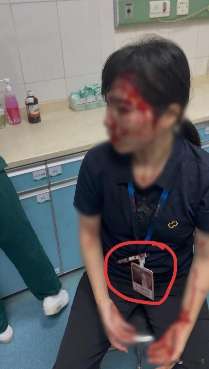 广东惠州女子被水杯砸伤后续，昨天陈女士还信誓旦旦的说，没有撬男同事的单，销售部的