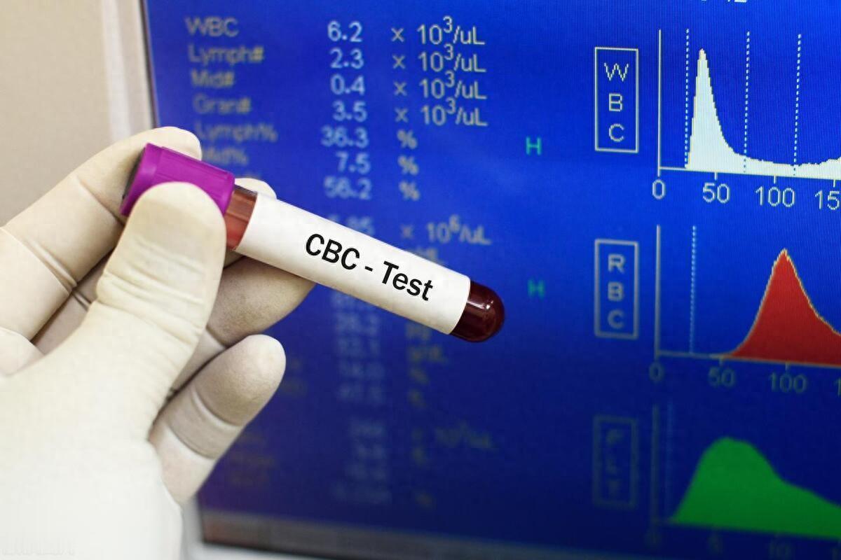 化疗后复查血常规，这4个指标正常，说明你恢复的不错！化疗其实就是用药物把肿瘤