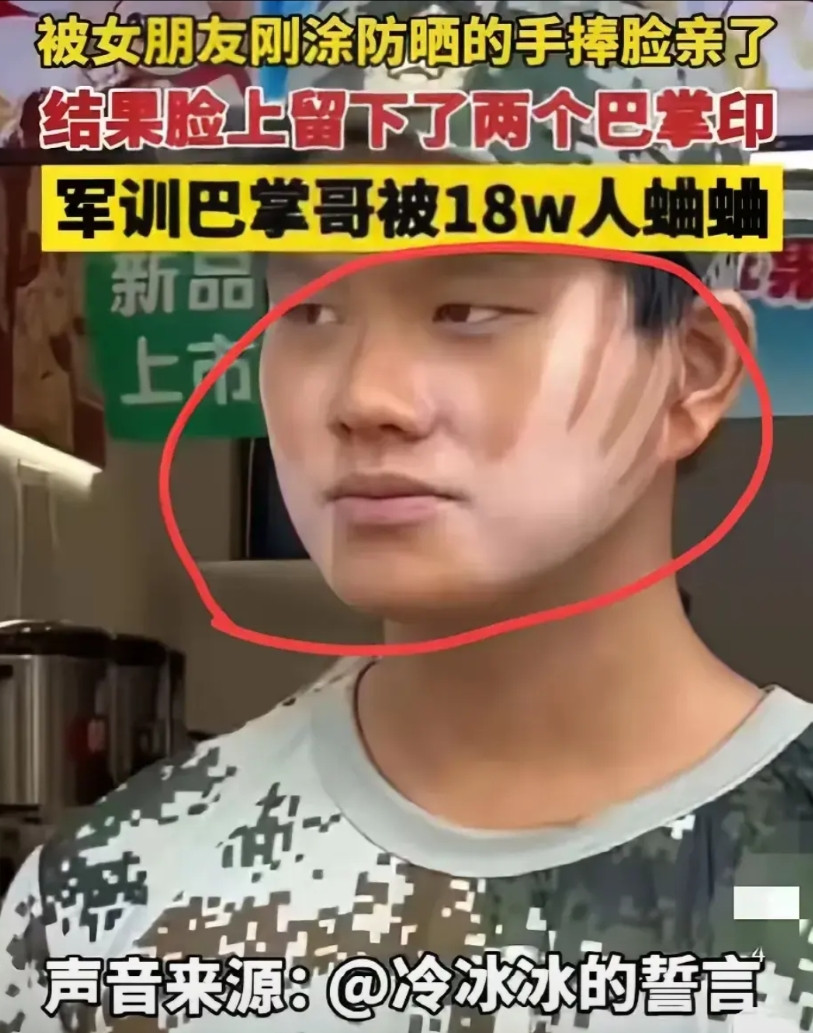 军训“巴掌脸”小哥火了！一男生军训时，被女朋友涂防晒的手捧脸亲了，结果脸上直