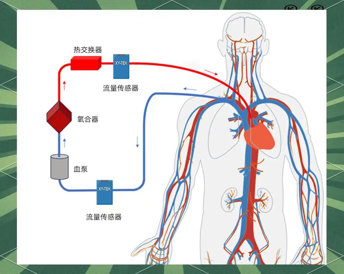 男子心脏停跳2天后生还！44小时无心跳，靠人工心肺奇迹复活近日，男子心脏停