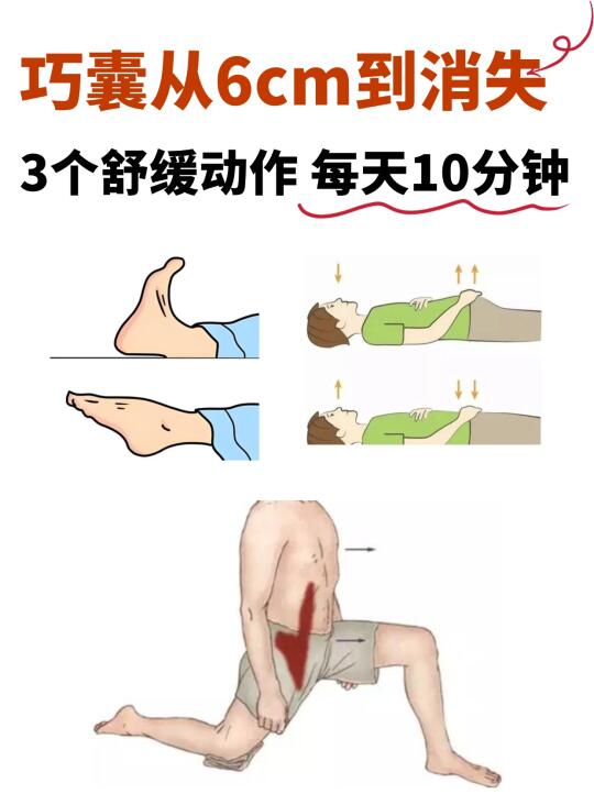 救命❗❗巧囊每天10分钟微动作，瞬间舒服了