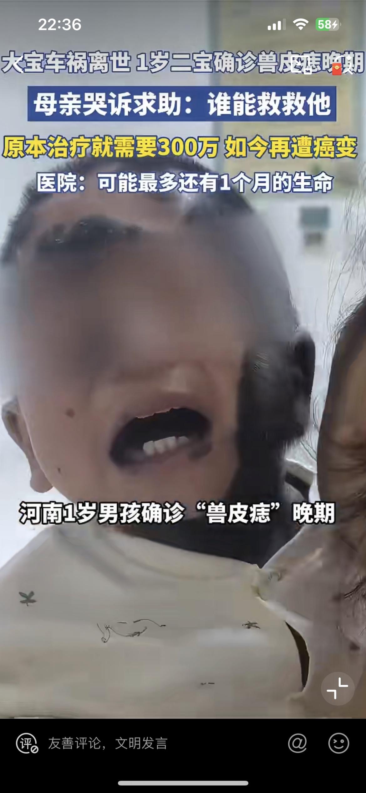 河南这个苦命的家庭，才一岁的孩子得了兽皮痣，如今已经癌变。6岁的大宝因车祸去世