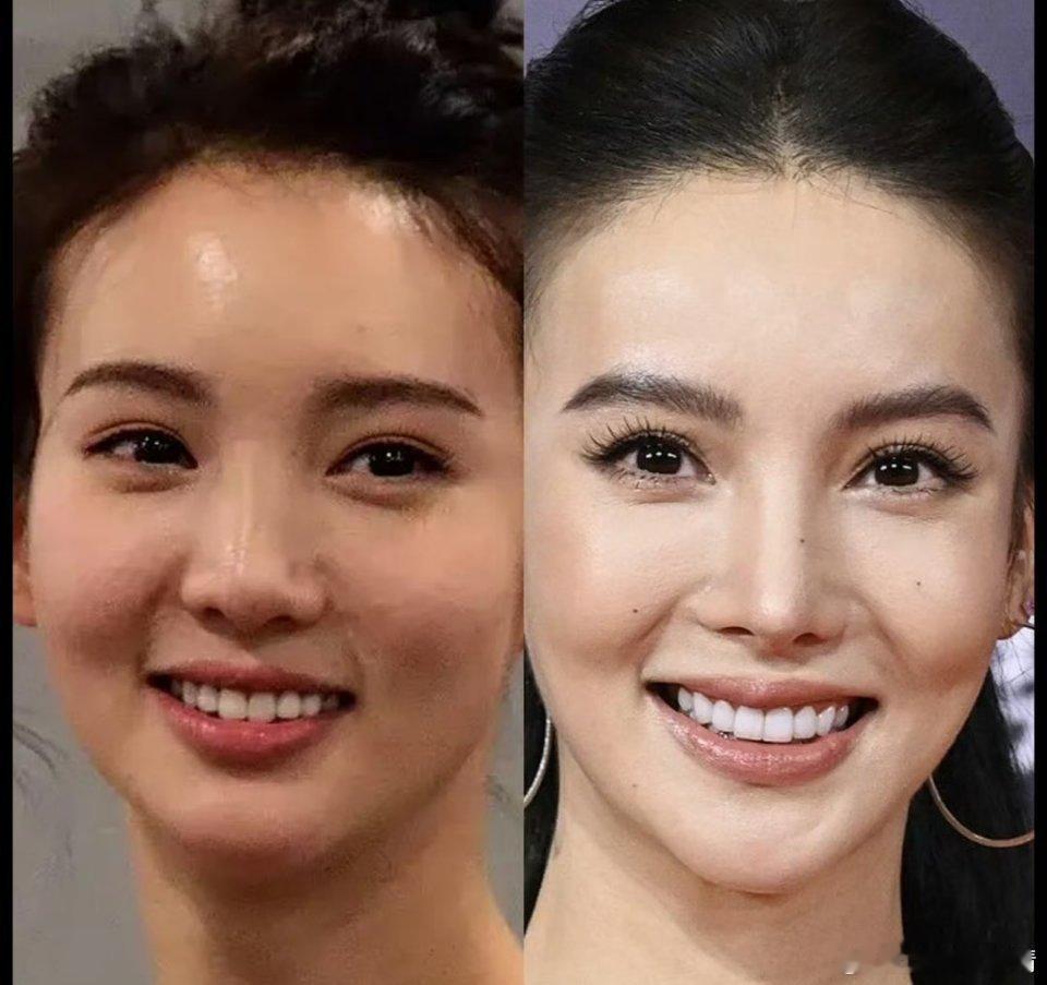 金晨脸部状态也没什么变化，主要是底子好​​​