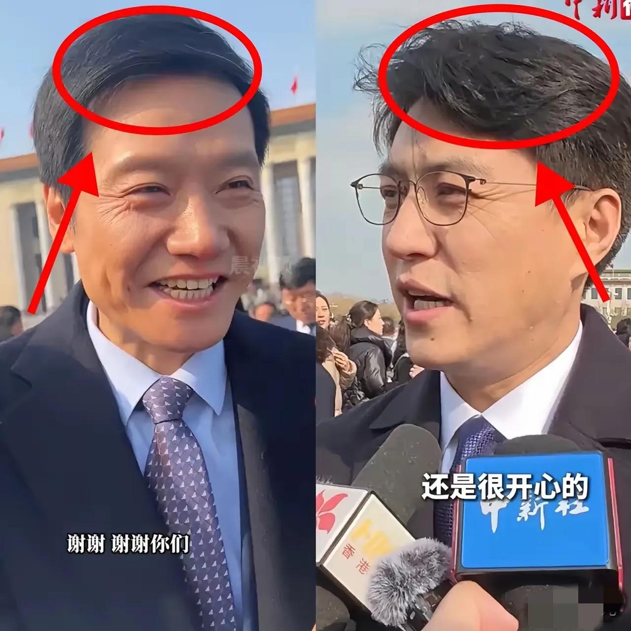 不仔细看根本看不出来！他俩的头发前面很像，就是翘起来的那种，这个发型衬的他俩很帅