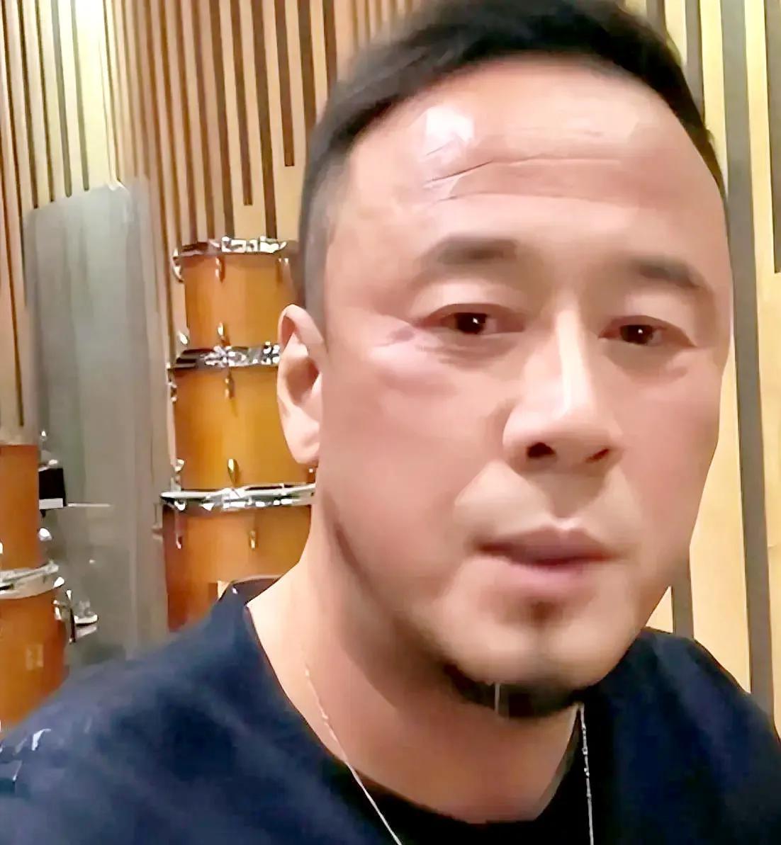 杨坤老师大棒了，终于拿起法律的武器对那些黑子了，据说杨坤老师就是太善良了。一次又