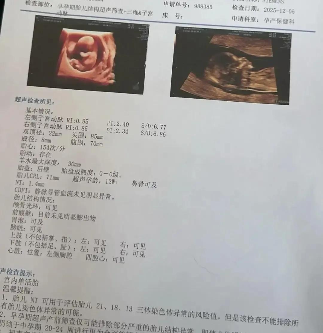 一个准妈妈产检时NT值略厚，医生一句“继续观察”，她当场在脑子里拍完八十集医疗剧