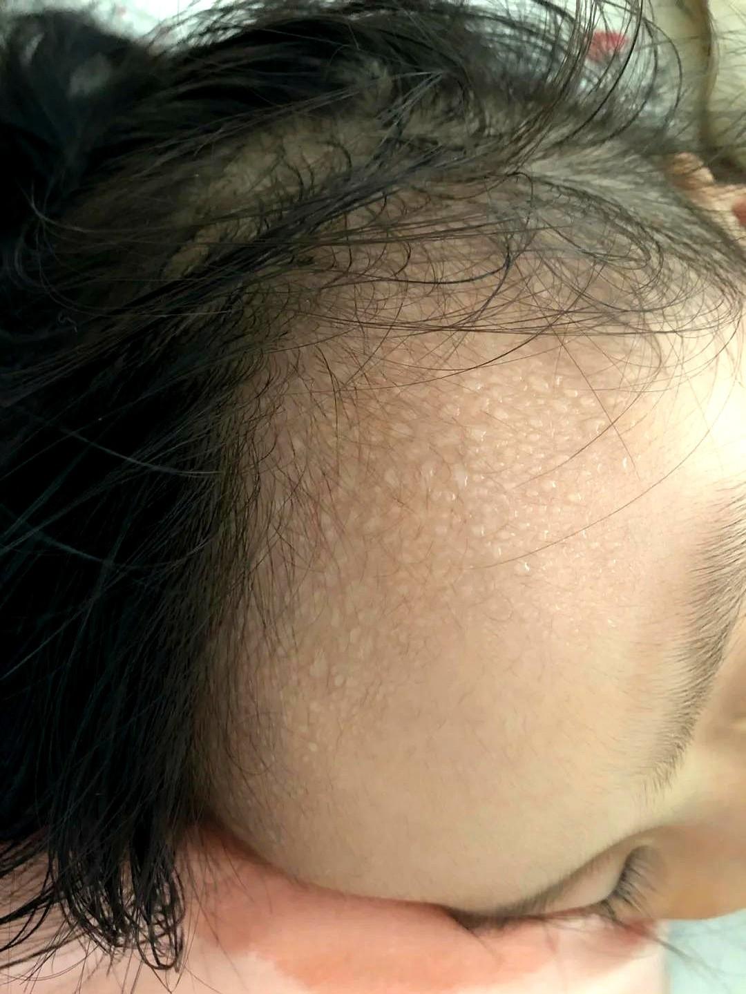 “孩子整夜汗湿枕头，家长还在等自愈？”空调开到23℃像冷藏室，娃的刘海还能拧出