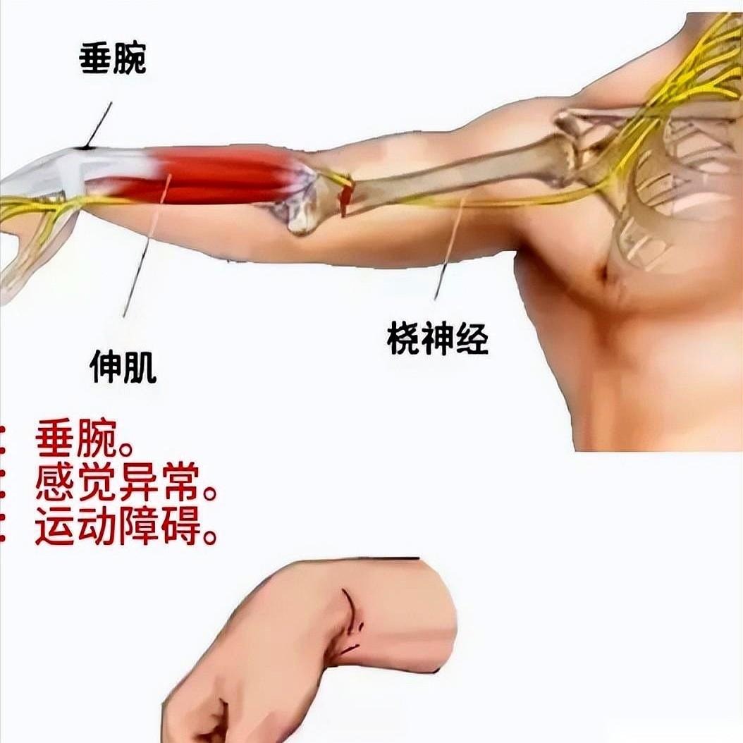 有一种疼，据说像是上万根针扎进肉里，还滋滋带电。白天咬牙还能扛，一到夜里，别人