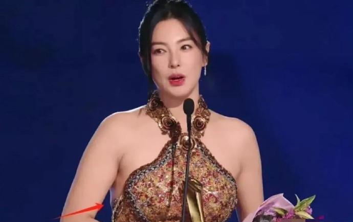 张雨绮这么多年一直肉嘟嘟的，完全没有身材焦虑​​​