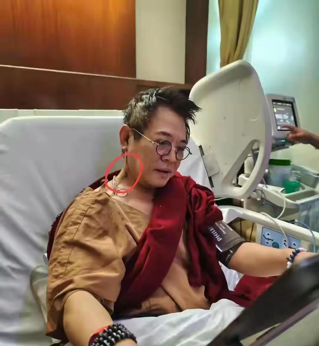 李连杰这个手术也是遭大罪了，脖子上动那么大一刀，确实风险很大，颈部有丰富的神经分