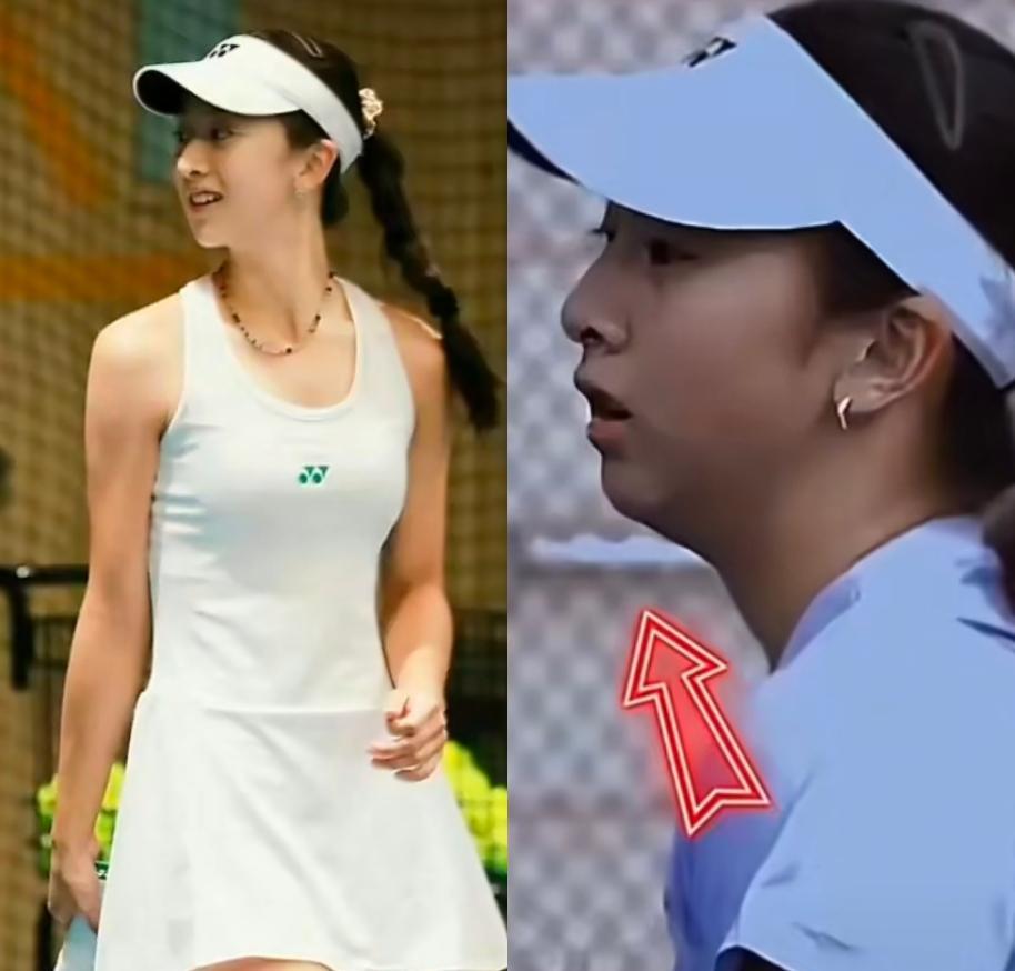 森碟下巴变长，颜值飙升，这背后是医美科技的魔法吗？我得说，这事儿真不简单。田