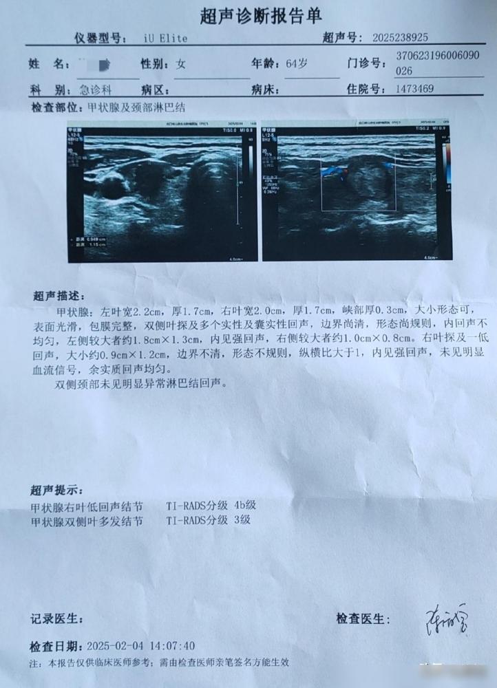 我竟不知道我是该高兴，还是该高兴呢？说真的之前我都快被甲状腺分级的科普吓出心