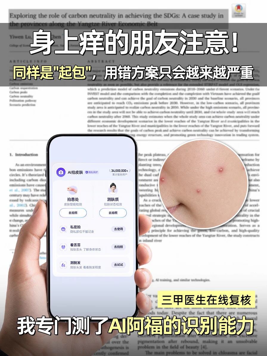 荨麻疹还是湿疹？我测了这个AI，结果出乎意料