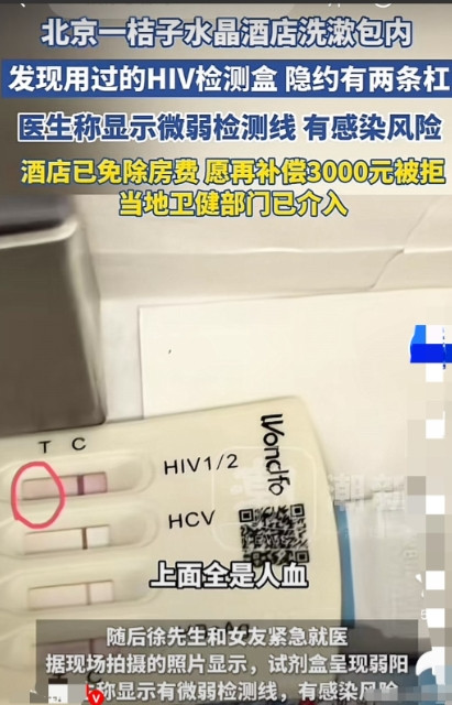 “太吓人了！”6月17日，北京，男子带着女友住酒店，洗漱完在清洁员给的洗漱包里发