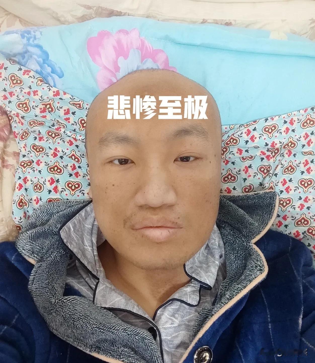 今天是悲惨至极的一天，妈妈哭了，我也哭了。春天得了周围性神经炎后一直躺在床上