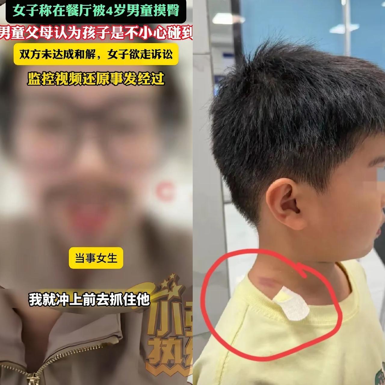 终于明白男孩父亲为什么要反诉熊仙女了，如果当初男孩不小心碰到她，她只是抓了男孩