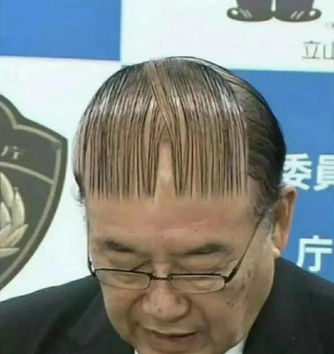 秃顶者的执念[笑着哭]。原来动画片也是来源于生活，一直以为动画片就是夸张，就是为了
