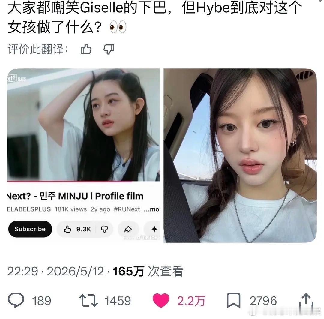 这脸动的真的是很明显了，肉是怎么提住的
