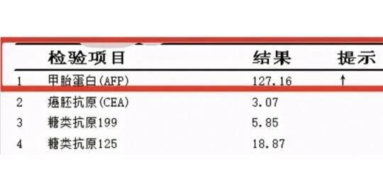 这两项指标异常 警惕原发性肝癌