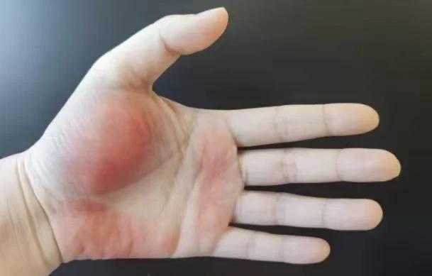 👆肝不好的人留意“一黄二红三黑”，伤肝的10个习惯要改改了！🫷肝脏