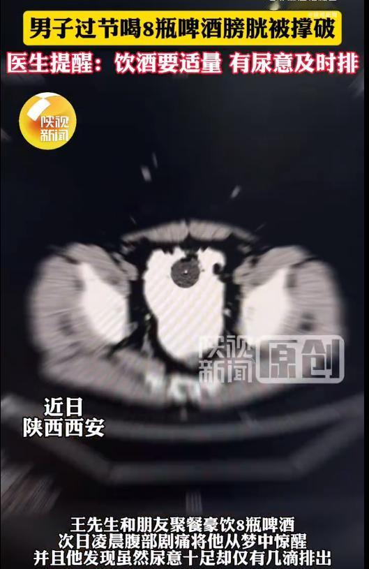 陕西一男子和朋友喝酒，连喝8瓶都没上厕所，回到家发现明明想撒尿却尿不出来了，去医
