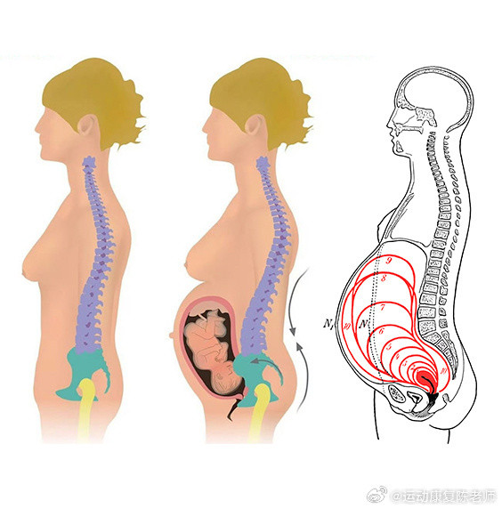 产后腰痛来看这张图，你就知道怀孕时子宫的变化，和为什么怀孕的妈妈，会容易腰痛了